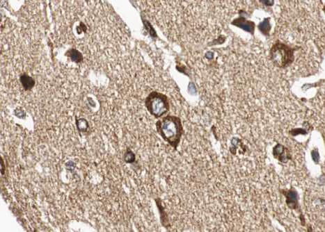 Polyclonal Rabbit anti-Human HSPA5 / GRP78 / BiP Antibody (IHC, IF, WB)
