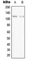 PPFIBP1 Antibody (Internal)