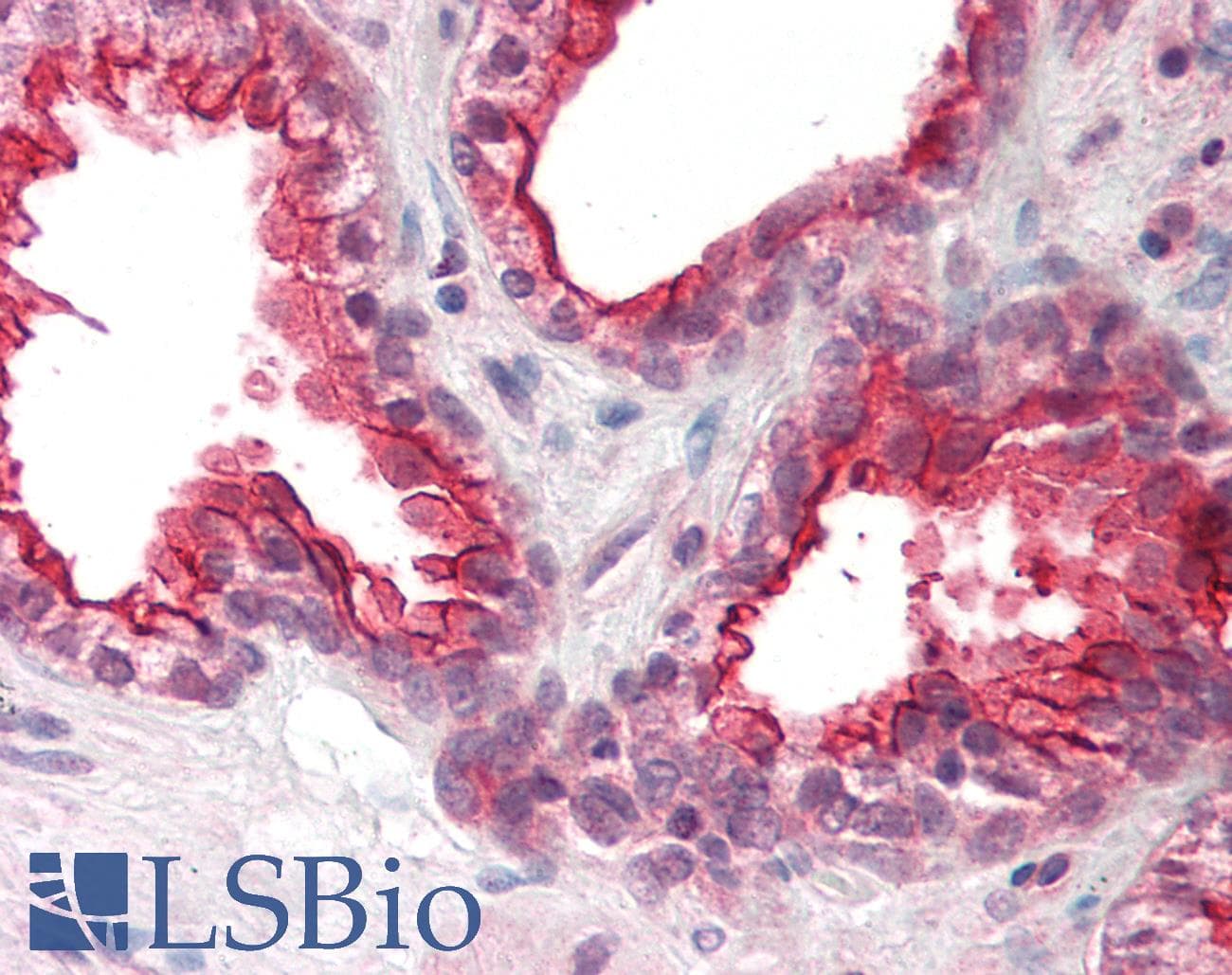 IHC-plus™ RAMP2 Antibody