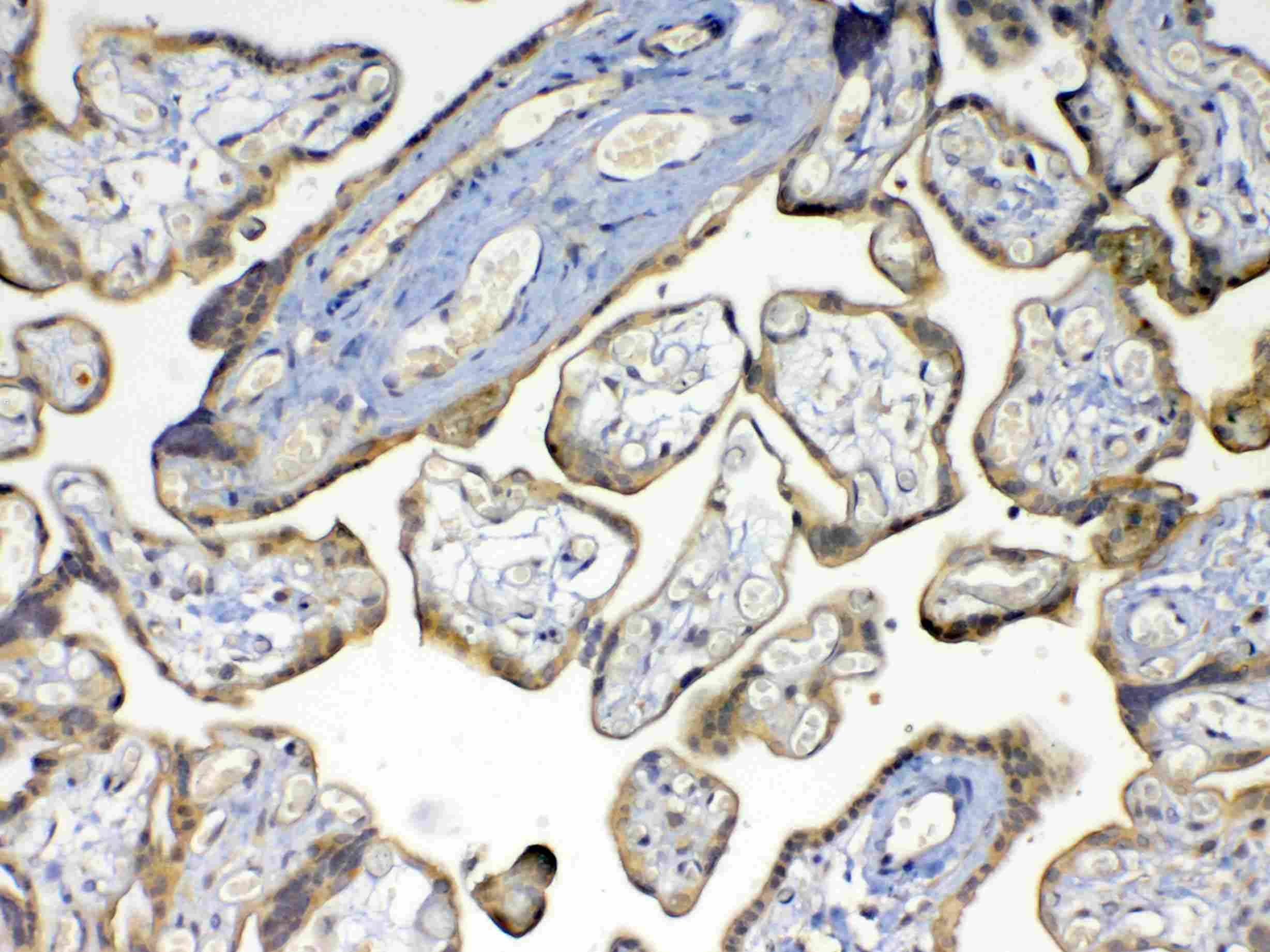 MMP16 Antibody