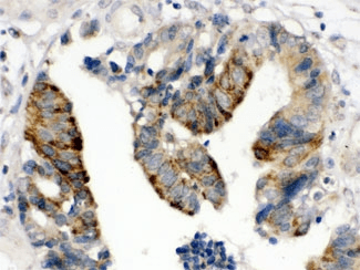 HMG2 / HMGB2 Antibody