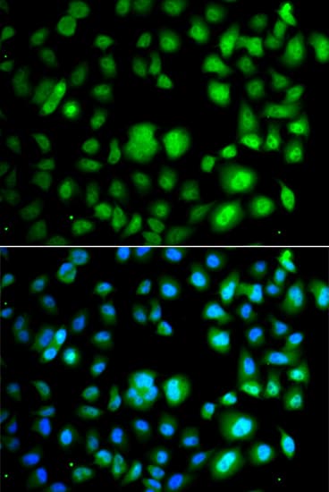 TET3 Antibody