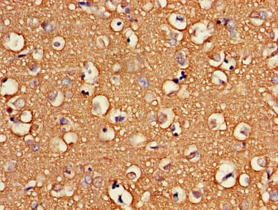 ATP6V1G2 Antibody