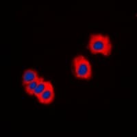 Polyclonal Rabbit anti-Human IRAK3 / IRAKM / IRAK-M Antibody (C-Terminus, IHC, IF, WB)