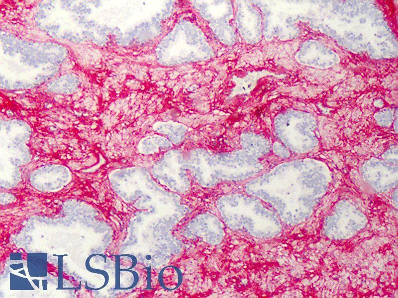 IHC-plus™ Collagen VI Antibody (Biotin)