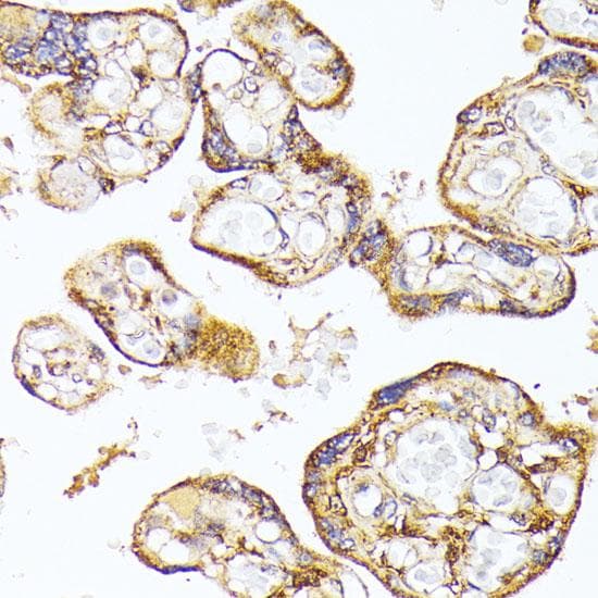 FLT1 / VEGFR1 Antibody