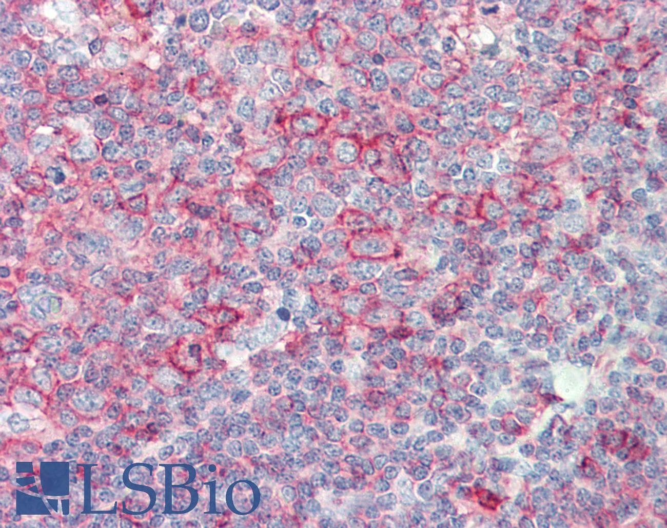 HLA-B Antibody (HRP)