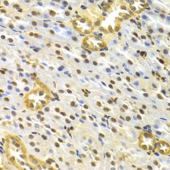 Polyclonal Rabbit anti-Human TP63 / p63 Antibody (IHC, IF, WB)