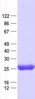 Human SPC25 Protein (Recombinant His, N-Terminal)