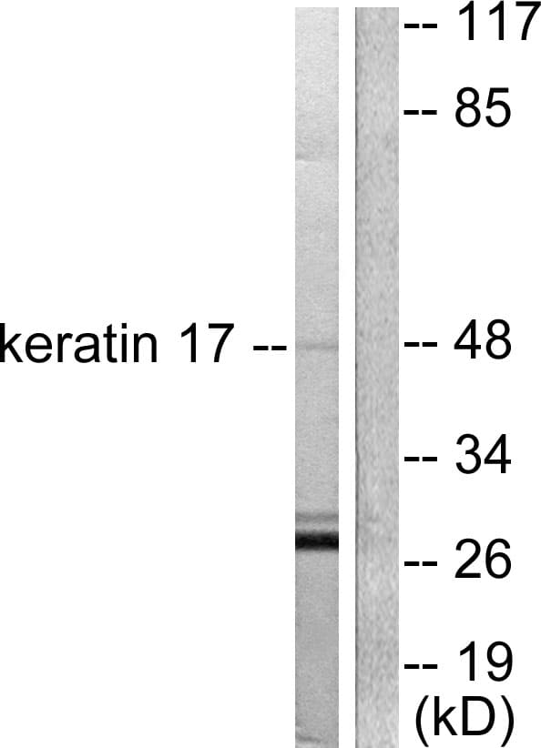 IHC-plus™ KRT17 / CK17 / Cytokeratin 17 Antibody (aa381-430)