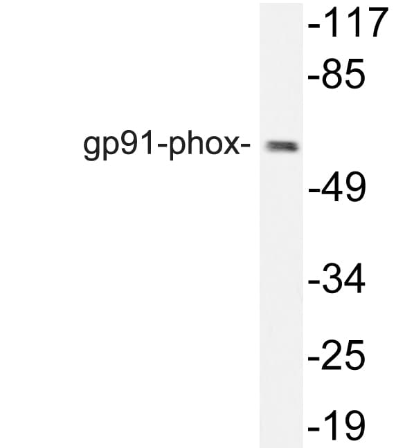 IHC-plus™ CYBB / NOX2 / gp91phox Antibody (aa471-510)