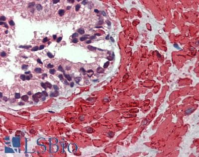 IHC-plus™ Muscle Actin Antibody (clone HHF35)