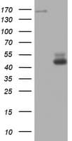 TOP2A / Topoisomerase II Alpha Antibody (aa1100-1531, clone OTI2A9)