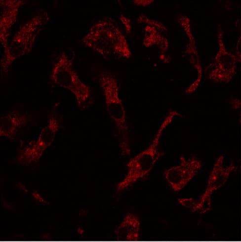 IHC-plus™ RAB8A / RAB8 Antibody (C-Terminus)