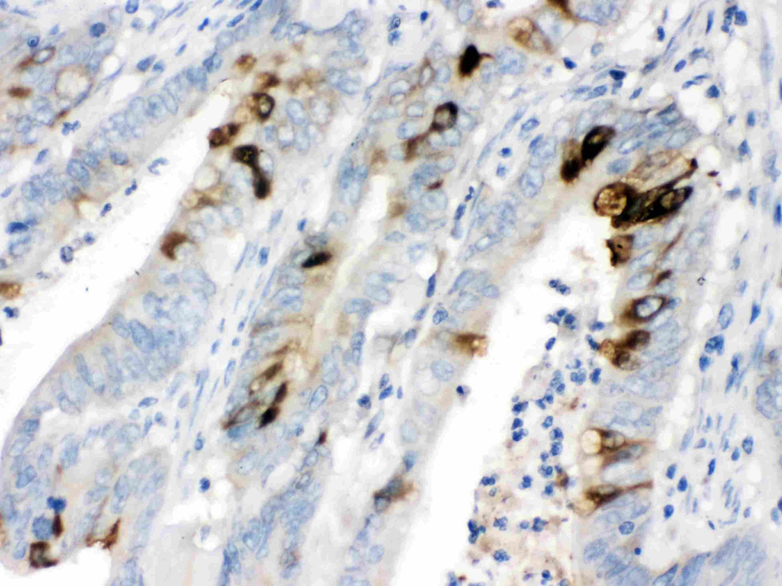 ITLN1 / Omentin Antibody