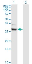 CIDEA / CIDE-A Antibody (clone 4B9)