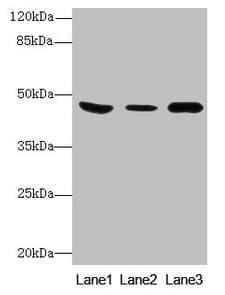 Polyclonal Rabbit anti-Human B4GALT5 Antibody
