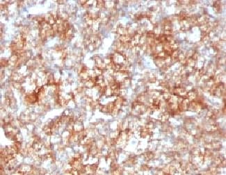 Basigin / Emmprin / CD147 Antibody (clone CDLA147)