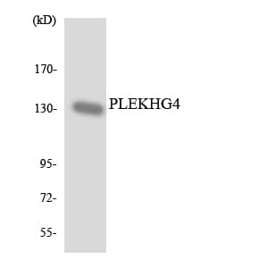 Polyclonal Rabbit anti-Human PLEKHG4 Antibody (aa636-685, WB)