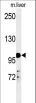 Polyclonal Rabbit anti-Human NR3C1/Glucocorticoid Receptor Antibody (aa236-262, IHC, IF, WB)