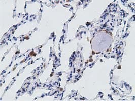 PECR Antibody (clone OTI1C9)