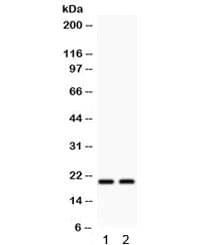 HSPB2 / HSP27 Antibody