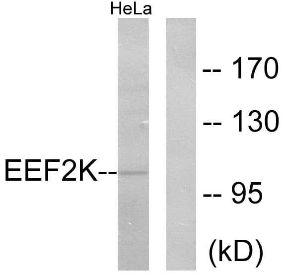 EEF2K Antibody (aa331-380)