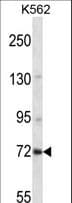 ZNF132 Antibody (aa151-179)