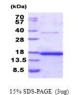 Human CD37 Protein (Recombinant His, N-Terminal)