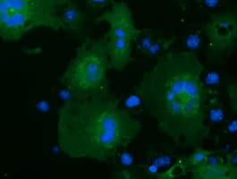 MOBKL2B / MOB3B Antibody (clone OTI3E11, Carrier-free)