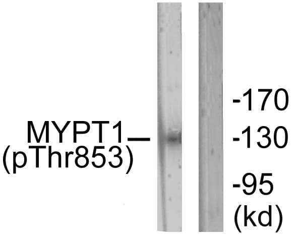 PPP1R12A / MYPT1 Antibody (phospho-Thr853)
