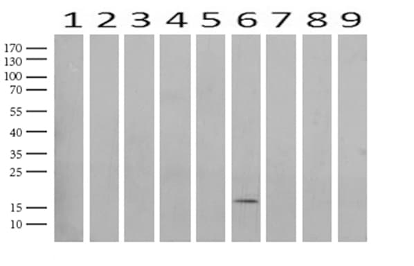 TNNC1 / Cardiac Troponin C Antibody (clone UMAB204)