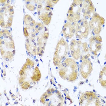 MRPL11 Antibody
