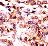 PANK1 / PANK Antibody (aa332-360)