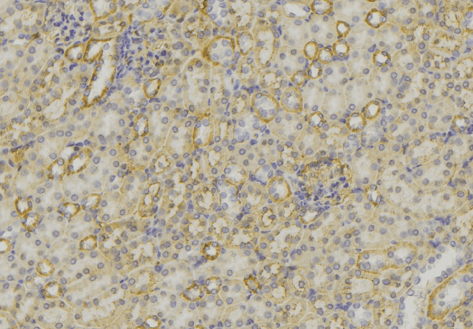 NTS / NT / Neurotensin Antibody