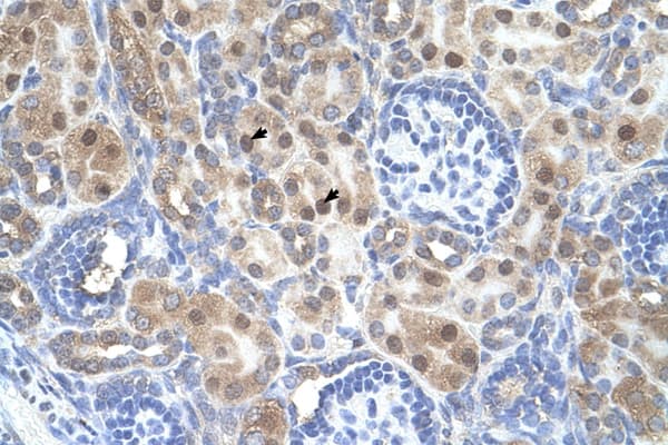 Polyclonal Rabbit anti-Human ARMCX6 Antibody (aa64-113, IHC, WB)