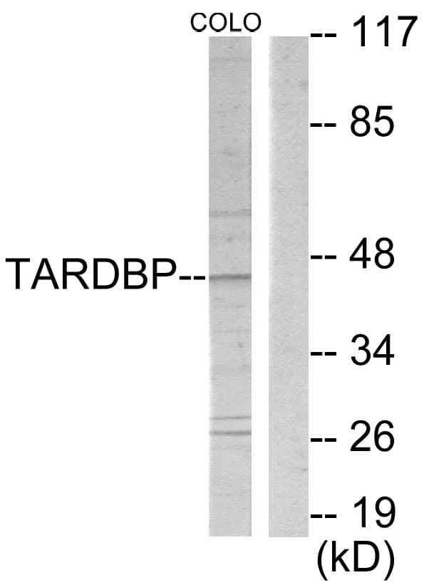 TBX1 Antibody (aa311-360)