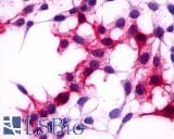 IHC-plus™ GPRC5A / RAI3 Antibody (C-Terminus)