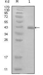 HPV11 E7 Antibody (clone 3D6F1)