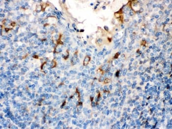 Polyclonal Rabbit anti-Human FLG / Filaggrin Antibody (IHC, WB)