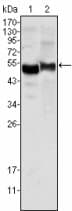 SERPINA1 / Alpha 1 Antitrypsin Antibody (clone 2B12)