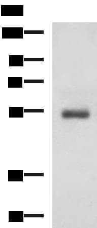 Polyclonal Rabbit anti-Human RHCG Antibody (IHC, WB)