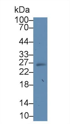 SOCS3 Antibody (aa1-225)