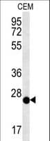Polyclonal Rabbit anti-Human CRISPLD2 Antibody (aa31-58, WB)