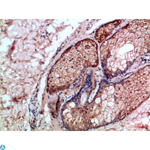 CASP1 / Caspase 1 Antibody
