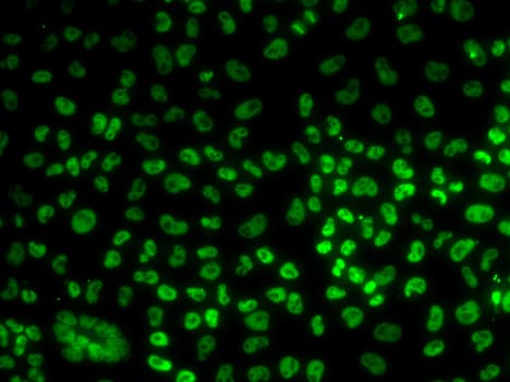 BUB3 Antibody
