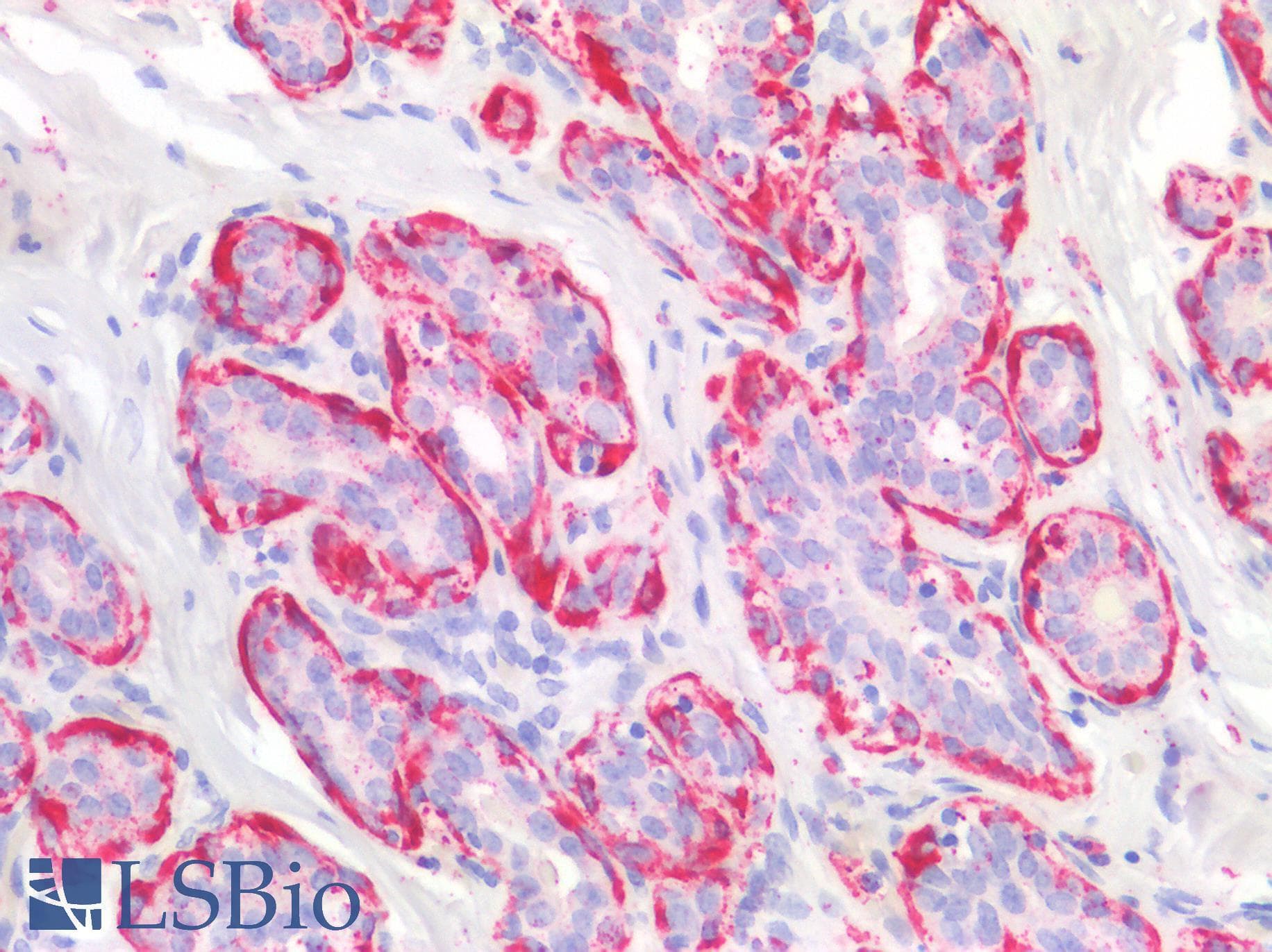 SMMHC / MYH11 Antibody