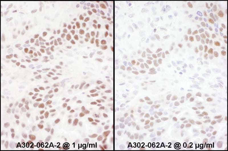 Polyclonal Rabbit anti-Human RELA / NFKB p65 Antibody (phospho-Ser536, IHC, WB)