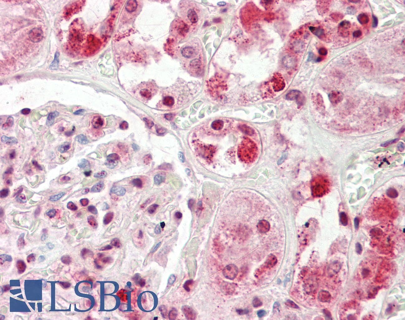 Polyclonal Rabbit anti-Human HECTD2 Antibody (aa684-733, IHC, WB)
