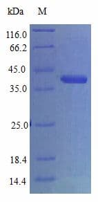 Human CYR61 Protein (Recombinant)
